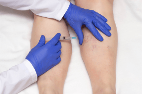 Microsclerotherapy-Training