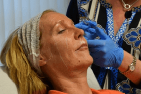 Non-surgical-face-lift-training-course-Cosmetic-Courses
